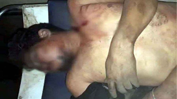 रायपुर में फिर चाकूबाजी, ढाबे में कुत्ते को खाना देने को लेकर विवाद, कुक ने मार दिया चाकू, युवक की मौत, पुलिस की हिरासत में दो संदेही