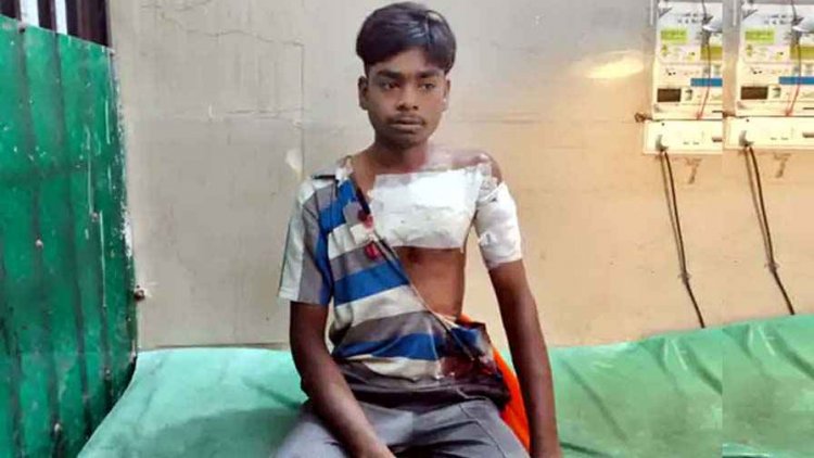 लिफ्ट मांगकर युवक पर जानलेवा हमला, बाइक से उतरते ही कटर से वार, सीने और हाथ में गंभीर चोट, आरोपियों की तलाश में जुटी पुलिस