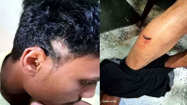 राजधानी में फिर चाकूबाजी, एक साल पुराने विवाद में युवक दोबारा भिड़े, पुलिस ने पीड़ित-आरोपी पर दर्ज किया केस, 2 आरोपी गिरफ्तार