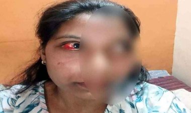 घर घुसकर पड़ोसी ने महिला की आंख में डाला मिर्च पाउडर, चाकू से हमला कर जान से मारने की धमकी देने का आरोप, आरोपी की तलाश में जुटी पुलिस