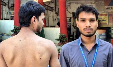 बाइक टकराने की मामूली घटना पर आईटीआई छात्र पर बदमाशों ने किया जानलेवा हमला, चेहरे और पीठ पर आई गंभीर चोटें, जांच में जुटी पुलिस