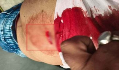 मंदिर परिसर में चाकूबाजी, शराब पीने से रोका तो युवक पर हमला, अस्पताल में भर्ती, इलाज जारी, इलाके में फैली सनसनी, चार आरोपी फरार, तलाश जारी