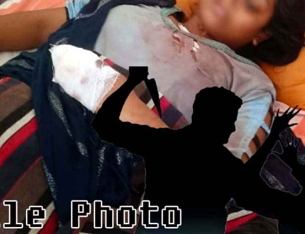 पति ने पत्नी पर किया जानलेवा हमला, महिला थाने के पास गला काटने की कोशिश, इलाज जारी, इलाके में मचा हड़कंप, जांच में जुटी पुलिस