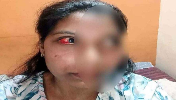 घर घुसकर पड़ोसी ने महिला की आंख में डाला मिर्च पाउडर, चाकू से हमला कर जान से मारने की धमकी देने का आरोप, आरोपी की तलाश में जुटी पुलिस
