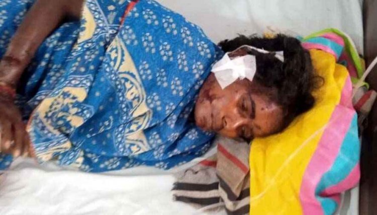 एक ही दिन में तेंदुए का दो बार हमला, महिला को आई गंभीर चोटें, बाल-बाल बचा युवक, दोनों घायलों का इलाज जारी, वन विभाग अलर्ट, ग्रामीणों में डर का माहौल