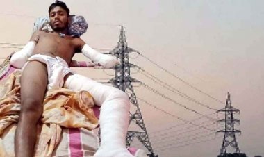 करंट से घायल महावीर के कट गए दोनों हाथ, पैसे कटने की तैयारी, इलाज कराने बेची जमीन, नहीं मिली सरकारी सहायता और आयुष्मान योजना का लाभ