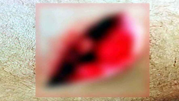 राजधानी में फिर चला चाक़ू, श्यामनगर में मोबाइल शॉप संचालक पर सरेराह चाकूबाजी, कारोबारी घायल, हालत नाजुक, आरोपी फरार, तलाश में जुटी पुलिस