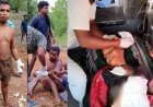 भालू ने दो जगह किया हमला, सुबह 5 बजे हुए अटैक से महिला गंभीर, सिर,पेट और सीने पर गहरी चोटें, जिला अस्पताल रेफर, इधर ग्रामीण घायल
