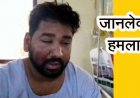 बोलेरो सवारों ने ASI के बेटे  को कुचला, पीछा करने वाले साथी का अपहरण कर बेरहमी से पिटाई, दो युवक गंभीर, जांच में जुटी पुलिस, CCTV फुटेज आया सामने