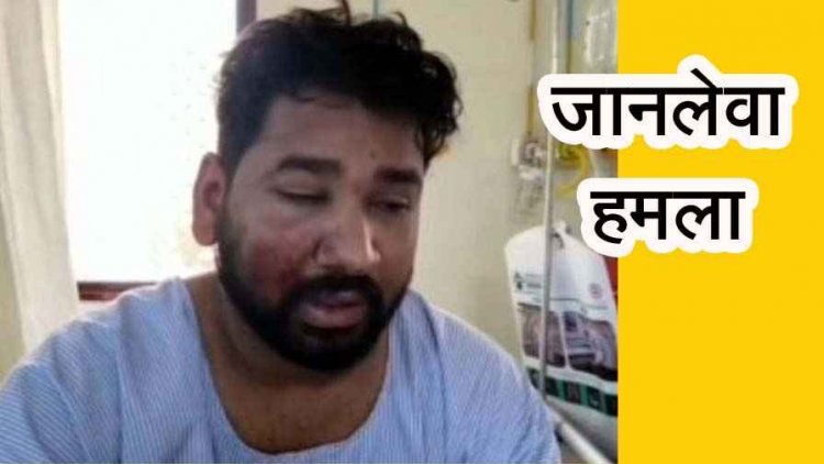 बोलेरो सवारों ने ASI के बेटे  को कुचला, पीछा करने वाले साथी का अपहरण कर बेरहमी से पिटाई, दो युवक गंभीर, जांच में जुटी पुलिस, CCTV फुटेज आया सामने