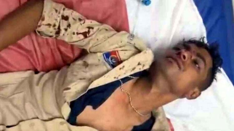 बाप-बेटे की लड़ाई शांत कराना सिपाही को पड़ा भारी,पिता पर चाकू लेकर दौड़ा बेटा, पुलिस पहुंची तो आरक्षक पर कर दिया हमला, जवान हमले से लहूलुहान