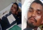 हरेली त्योहार पर मुर्गा छोटा-बड़ा लाने की बात पर दो भाइयों के बीच खूनी जंग, बड़े ने छोटे भाई को चाकू मारकर किया जानलेवा हमला, आरोपी फरार