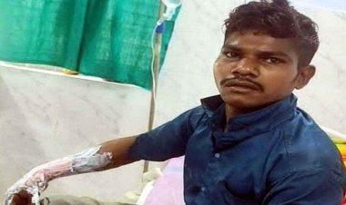 पत्नी पर कमेंट, दोस्त को जिंदा जलाने की कोशिश, युवक ने पेट्रोल डालकर लगाई आग, पीड़ित ने तालाब में कूदकर बचाई जान, आरोपी लीला गिरफ्तार