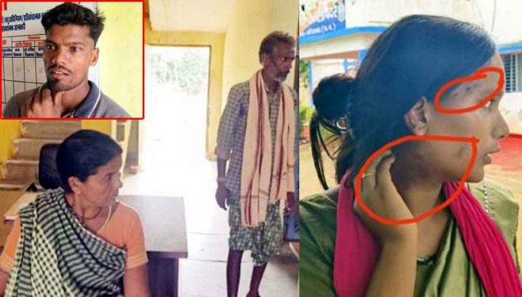 सब्जी में नमक कम पड़ा तो ‘गुड़ाखू की सजा’!, सास-ससुर पर बहू के मुंह में जबरन गुड़ाखू ठूंसने और नाक में तेल डालने का आरोप, नमक कम था या इंसानियत?
