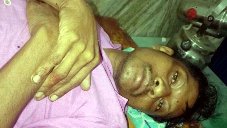 खेत जा रहे ग्रामीण पर दो भालुओं ने किया हमला, पेट, गुप्तांग और सीने में आई चोटें, परिजनों ने घायल को पुल नहीं होने से कंधे पर रख नदी पार कराया