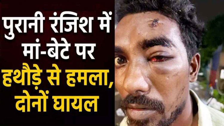 रायपुर में मां-बेटे पर हथौड़े से हमला, मचा हड़कंप, पुरानी रंजिश में आरोपी ने की वारदात, हमले में मां और बेटा दोनों घायल, मामला दर्ज, जांच में जुटी पुलिस