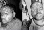 आधी रात राहगीर पर भालुओं के झुंड ने किया हमला, चीख-पुकार सुनकर मौके पर पहुंचे ग्रामीण, ग्रामीणों ने बचाई जान, युवक गंभीर, गंभीर हालत में रायपुर रेफर