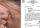 स्कूल में छात्रा से मारपीट के मामले में बाल अधिकार आयोग सख्त, जिला शिक्षा अधिकारी को भेजा नोटिस, 22 अक्टूबर तक मांगी जांच रिपोर्ट