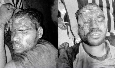 आधी रात राहगीर पर भालुओं के झुंड ने किया हमला, चीख-पुकार सुनकर मौके पर पहुंचे ग्रामीण, ग्रामीणों ने बचाई जान, युवक गंभीर, गंभीर हालत में रायपुर रेफर