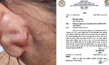 स्कूल में छात्रा से मारपीट के मामले में बाल अधिकार आयोग सख्त, जिला शिक्षा अधिकारी को भेजा नोटिस, 22 अक्टूबर तक मांगी जांच रिपोर्ट