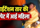 खेत में काम के दौरान टूटे हाईटेंशन तार की चपेट में आई महिला, करंट से झुलसने के बाद कटकर अलग हुआ एक हाथ, विद्युत व्यवस्था पर उठे सवाल