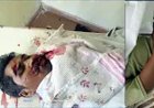 कुरूद में अज्ञात वाहन की टक्कर से गंभीर रूप से घायल बाइक सवार युवक ने अस्पताल में तोड़ा दम, तेज रफ्तार बनी हादसे के वजह!