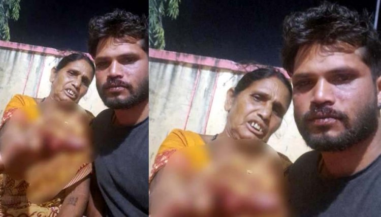 घर में घुसकर मारपीट, कुल्हाड़ी से हमला करने की कोशिश का आरोप, मां के हाथ में आई गंभीर चोट, तीन आरोपियों के खिलाफ एफआईआर दर्ज