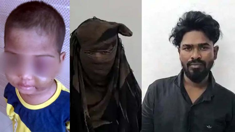 रायपुर में मासूम बच्चों पर अत्याचार, हाथ में फ्रैक्चर, आंख सूजी और पीठ पर दागा सिगरेट, बेरहमी से पिटाई, सगी मां समेत सौतेला पिता गिरफ्तार