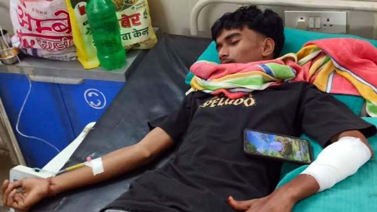 मोमोस खाकर साइकिल से घर लौट रहे नाबालिग पर बाइक सवार दो अज्ञात लोगों ने किया हमला, जांच में जुटी पुलिस, दोनों आरोपियों की तलाश जारी